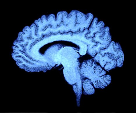 Brain Scan